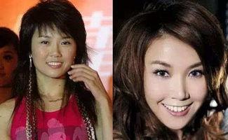 爆料娱乐圈没整容明星