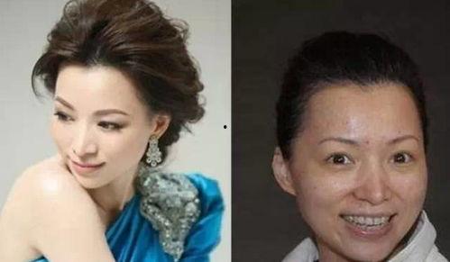 爆料娱乐圈没整容明星